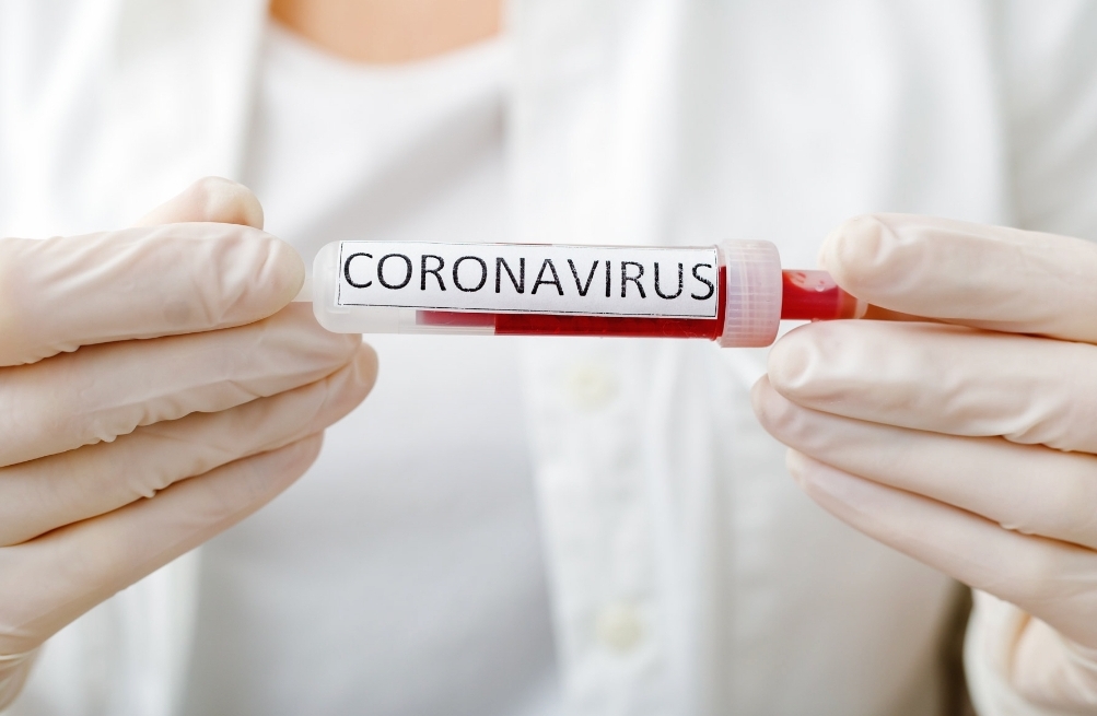 You are currently viewing Medic: Profilul pacientului s-a schimbat. Persoanele până în 50 de ani afectate de coronavirus