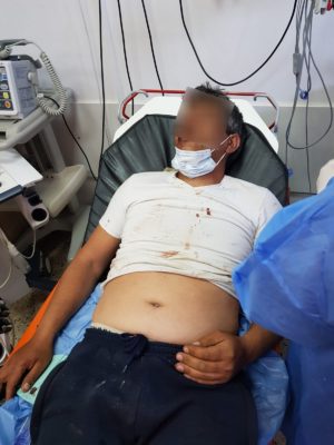 Read more about the article DÂMBOVIȚA: BĂRBAT DIN ȘUȚA SEACĂ A AJUNS LA SPITAL CU RĂNI GRAVE. A FOST BĂTUT CU BESTIALITATE