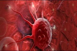 Read more about the article În România, 37 de pacienţi români cu cancere de sânge aşteaptă un donator compatibil