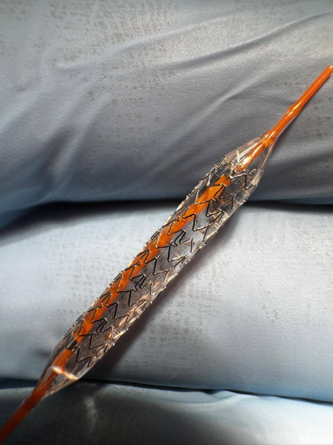 You are currently viewing Ovidiu Țoni, cardiolog dâmbovițean: La Târgoviște, în ultimul an, sute de pacienți au beneficiat de tratament prin implantare de stent, redându-le șansa la o viață normală